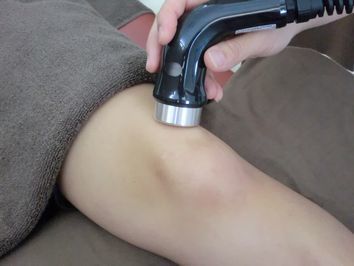 肉離れに対する超音波治療
